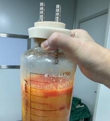 南城水动力吸脂手术要做多久？